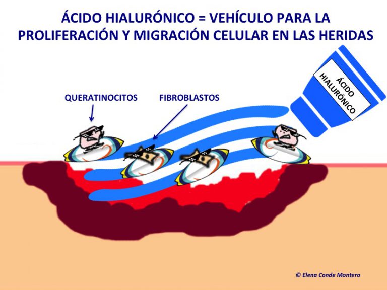 El porqué del boom del ácido hialurónico en las heridas