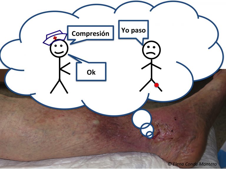 Ante una úlcera venosa, ¡sin compresión no hay opción!