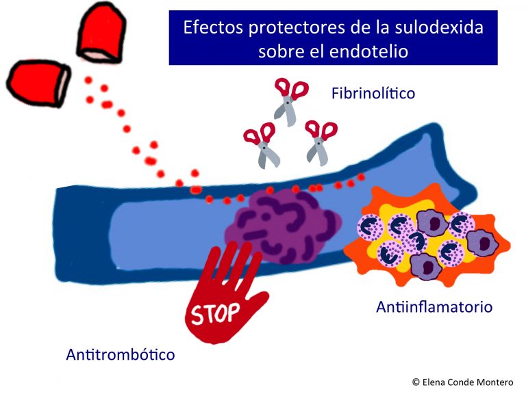 La sulodexida: una pastilla contra el daño endotelial por la hipertensión venosa