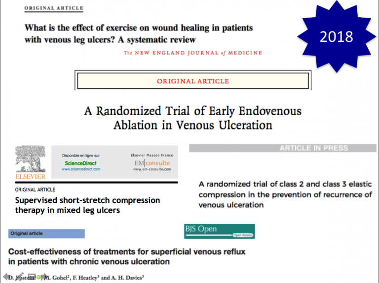 5 recent publications on the treatment and prevention of venous ulcers