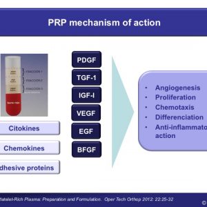 PRP mechanism of action