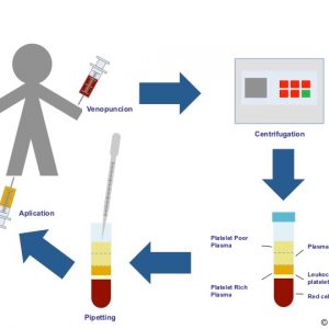 PRP production