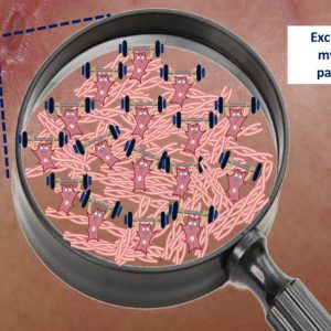 myofibroblasts scar hypertrophyc