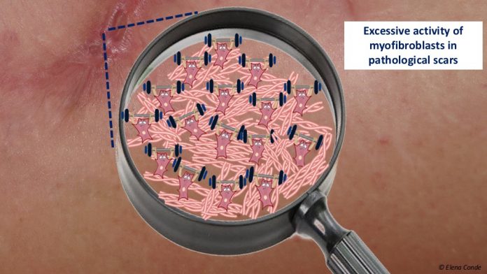 Myofibroblast: the great ignored of wound healing - Elena Conde