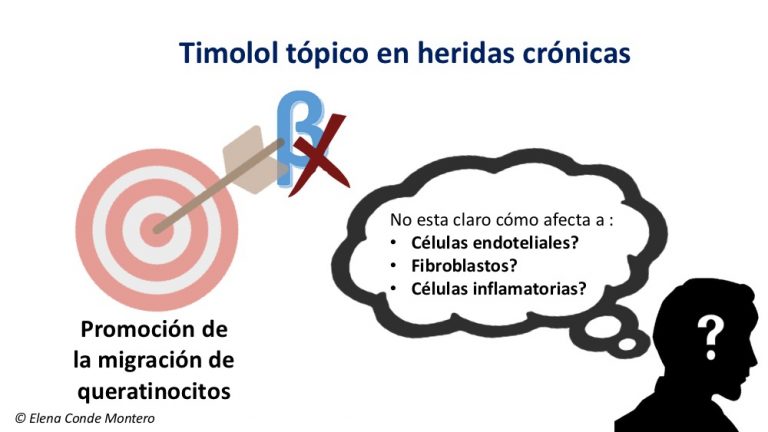 ¿Timolol en heridas crónicas?