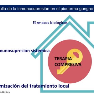 Inmunosupresión pioderma gangrenoso