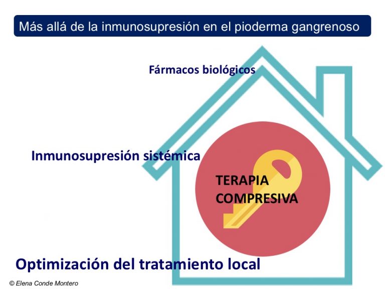 ¿Cómo conseguir que una úlcera por pioderma gangrenoso cierre antes?