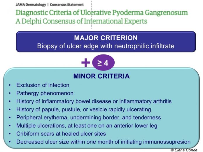 How to promote healing in ulcers secondary to pyoderma gangrenosum?