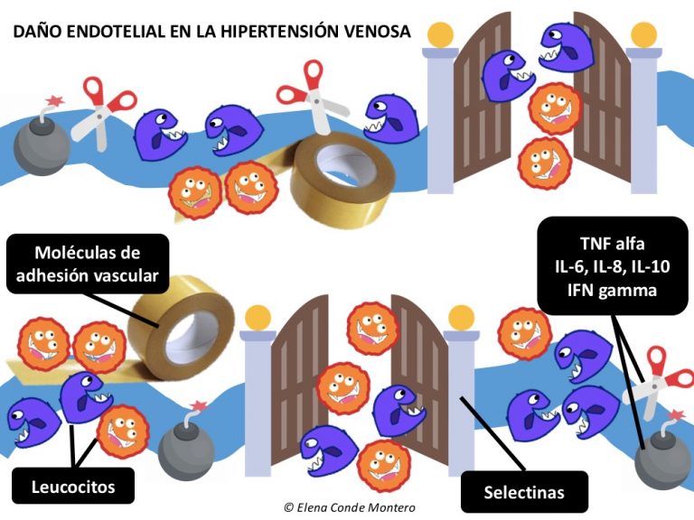 La importancia de los cambios proteómicos en la úlcera venosa