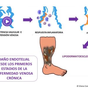 daño endotelial primeros estadios