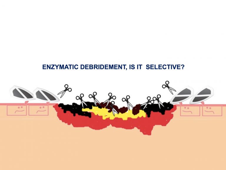 Enzymatic debridement: to what extent is it selective