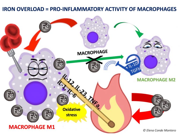 Iron, ochre dermatitis and venous disease