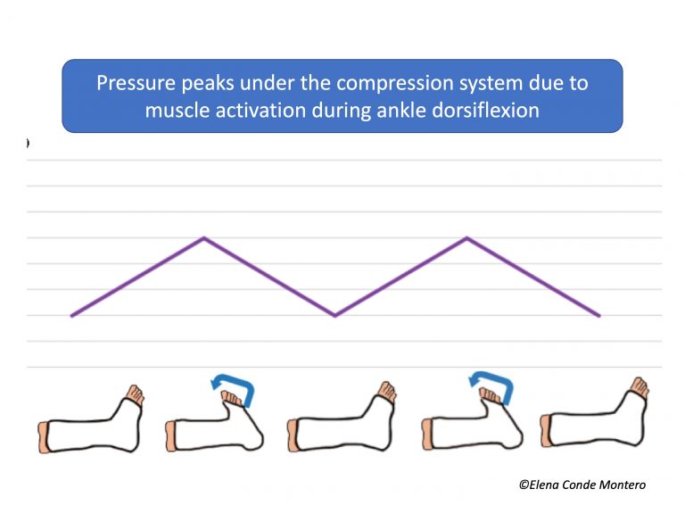 What exercises can I do at home for phlebolymphedema?