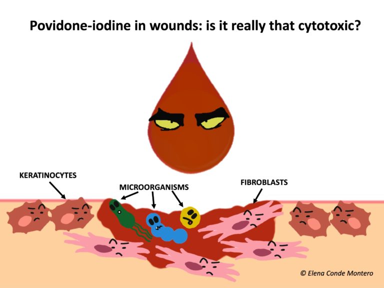 Povidone-iodine and chronic ulcers: a great controversy