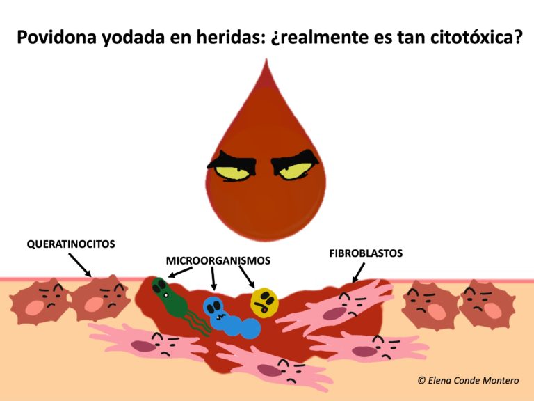 Povidona yodada y úlceras crónicas: una gran controversia