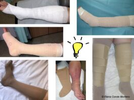 Chronic venous insufficiency from a dermatological perspective - Elena  Conde Montero