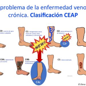 clasificación CEAP actualizada