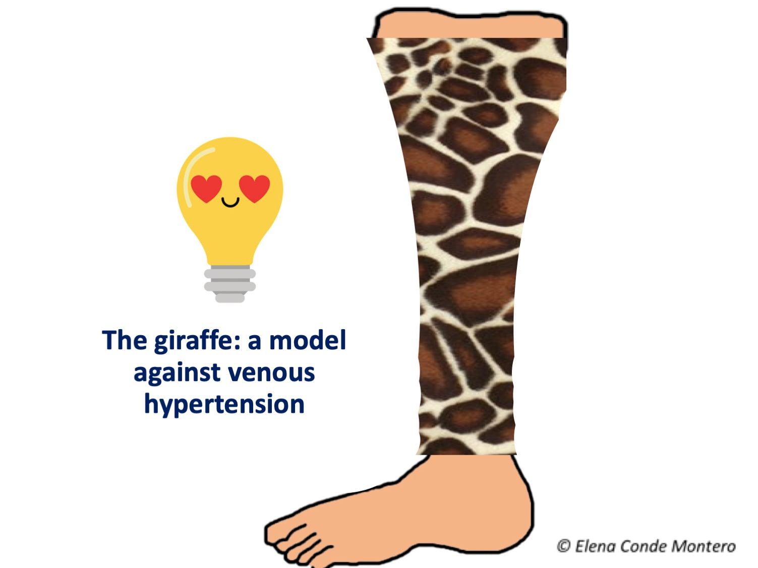 Leg Ulcers and Compression Therapy