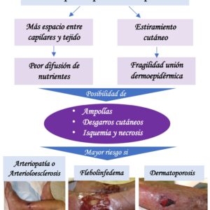 insuficiencia cardiaca úlceras