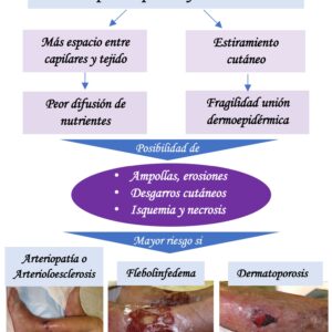 úlceras insuficiencia cardíaca