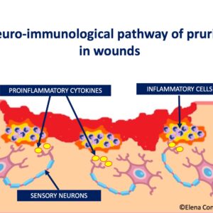 PRURITUS WOUNDS