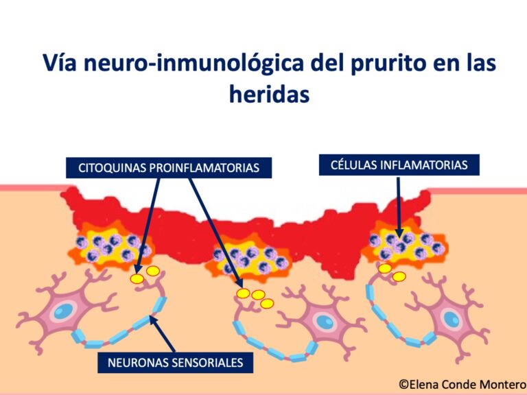 ¿Por qué pican las heridas?