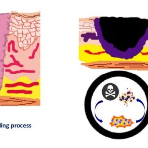 vicious cycle necrosis inflammation