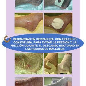 heridas en maléolo por dormir de lado