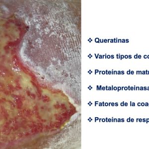 proteínas en el esfacelo